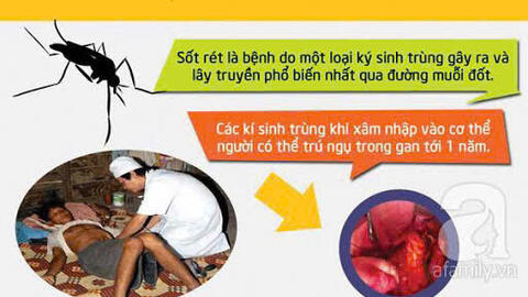 Bệnh sốt rét triệu chứng, nguyên nhân và cách phòng tránh